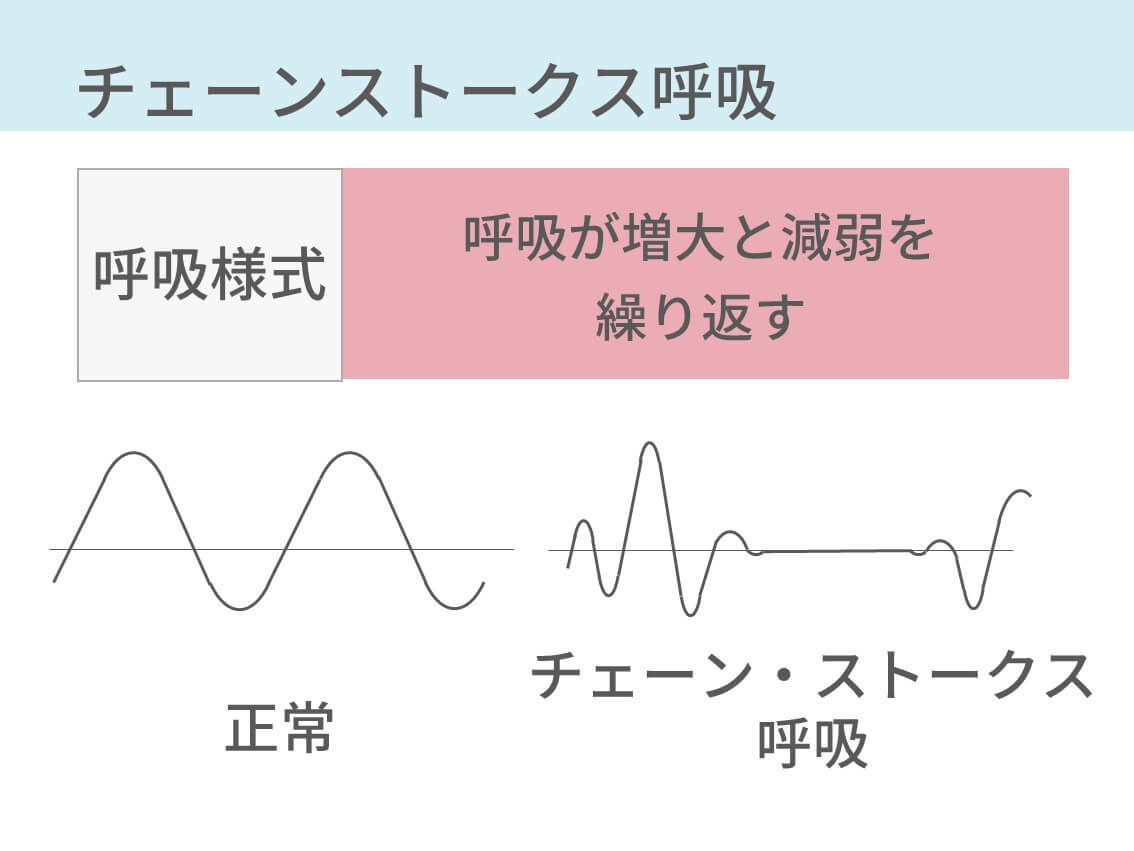 チェーンストークス呼吸とは？原因と終末期の余命・看取り対応を解説