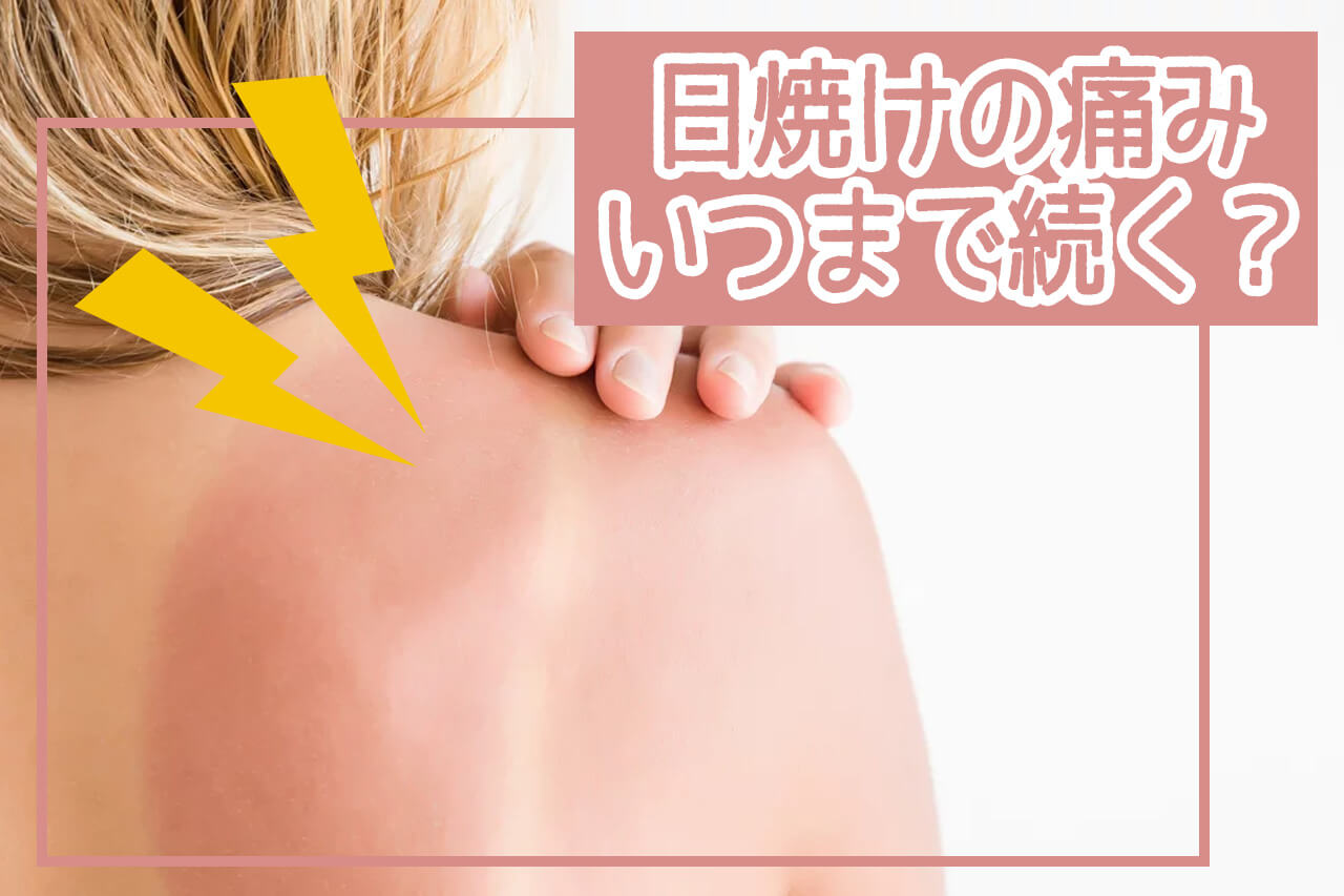 日焼けの痛みが治らない夜に読む完全対策マニュアル