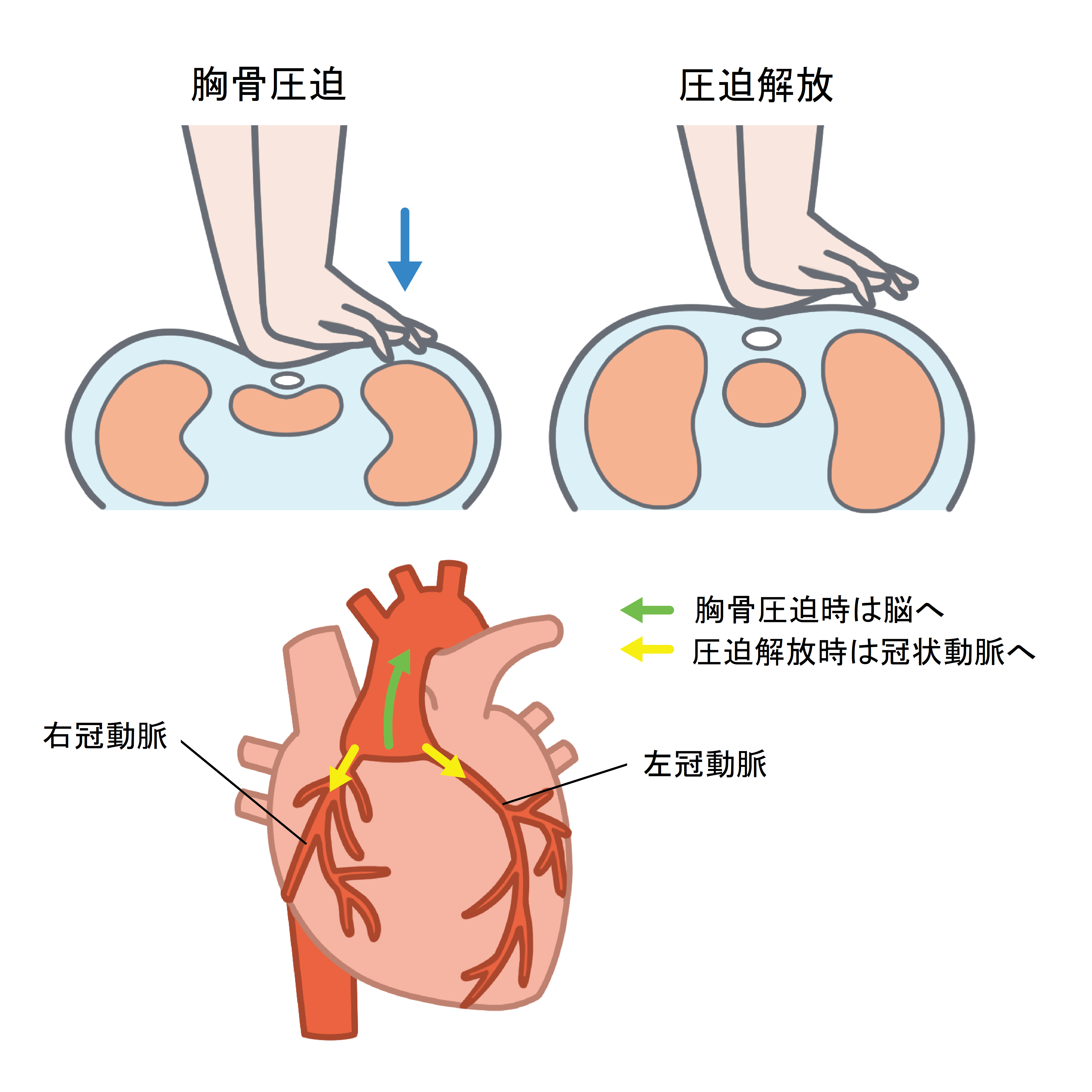 心肺停止とは？死亡との違いやニュースで即死と報じない真相を解明