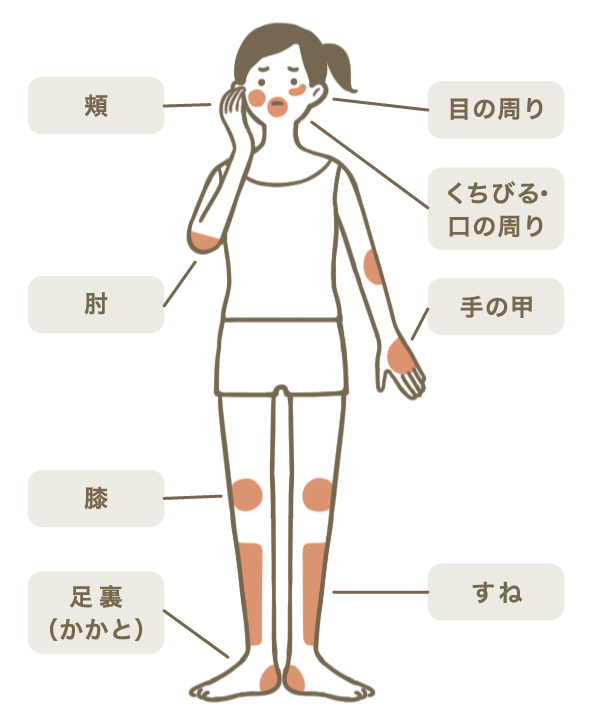 乾燥麹と生麹の違いは？換算・戻し方から保存・効果まで徹底比較