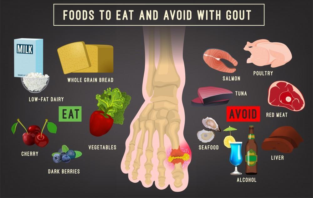 What Foods Should You Not Eat When You Have Gout