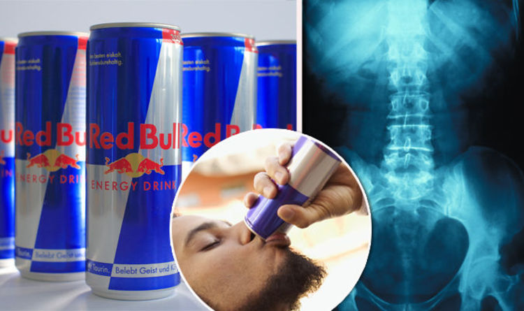 Can Red Bulls Kill You
