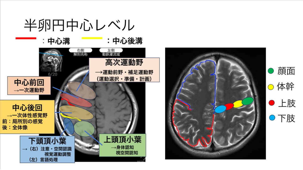 脳画像スライスレベル判読の極意｜臨床現場で迷わない断面見分け方