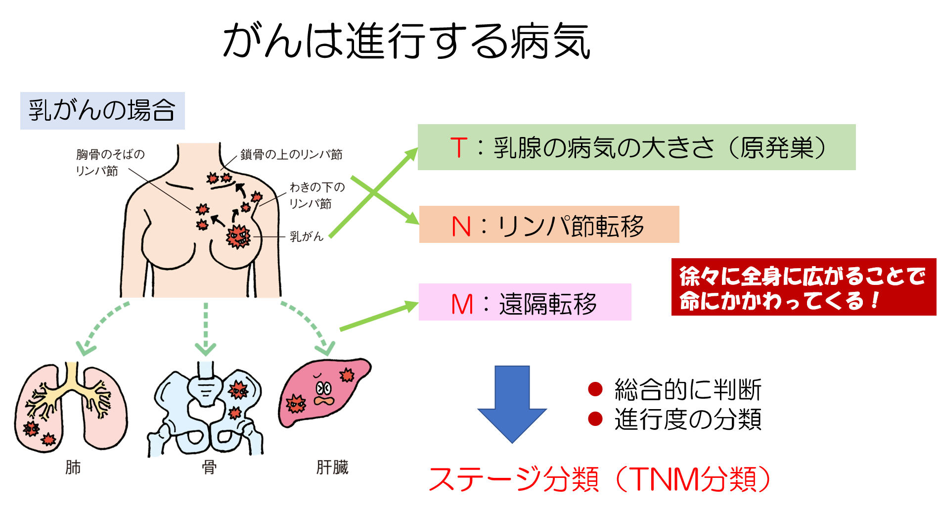 乳がんのタイプで何が変わる？4大分類の特徴・進行速度と最新治療法