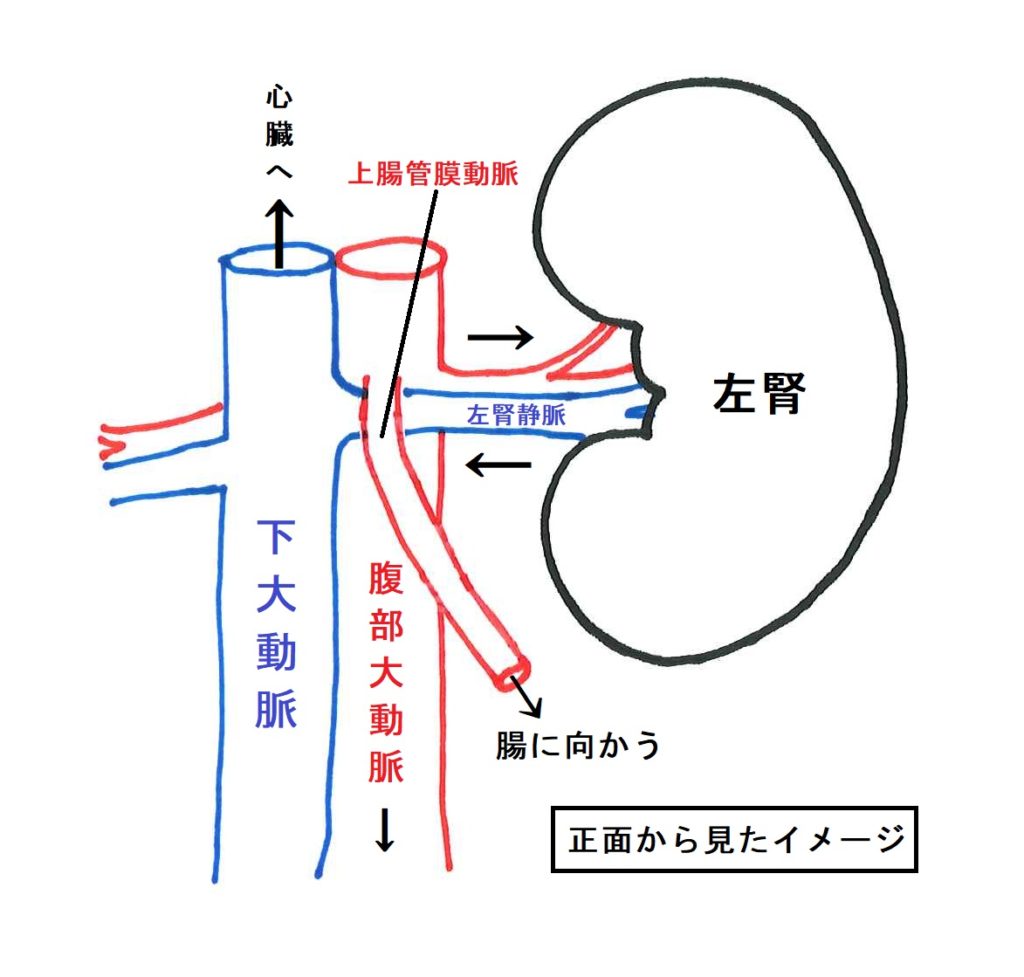 原因不明の血尿や腹痛？ナットクラッカー症候群の症状と最新治療