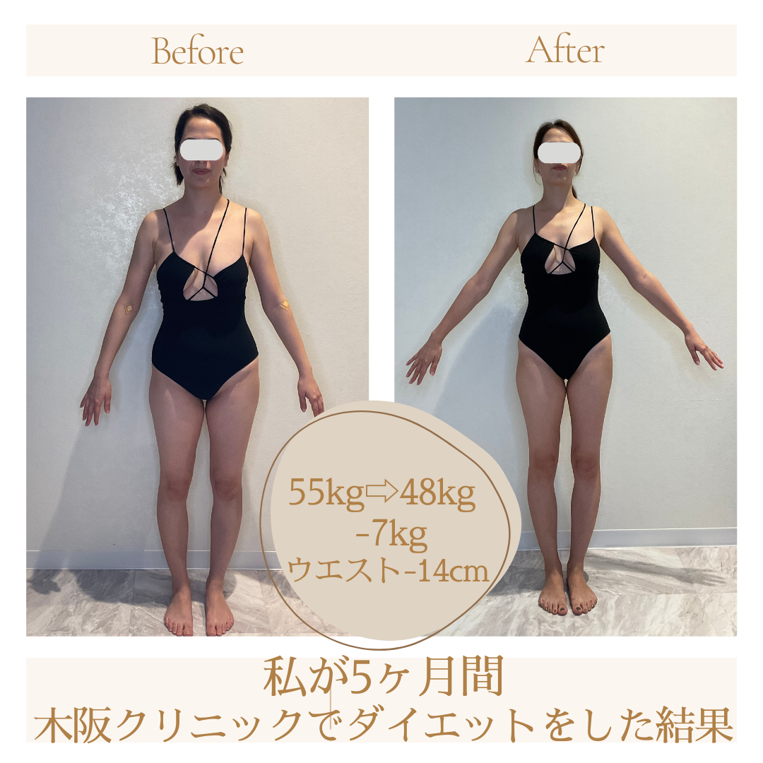 木坂クリニックの評判や口コミは？医師の経歴やネット予約を徹底解説