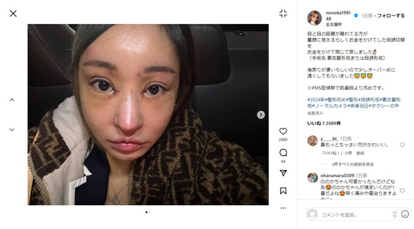 桜井ののかが語る「整形と老い」の真実。総額3000万円超のアップデートを経た彼女が、2026年の今たどり着いた境地とは