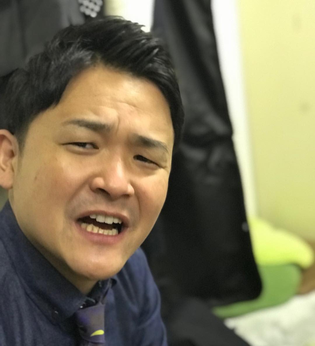 千鳥ノブの顔写真と表情のクセ！似てる芸能人や劇的変化を徹底検証