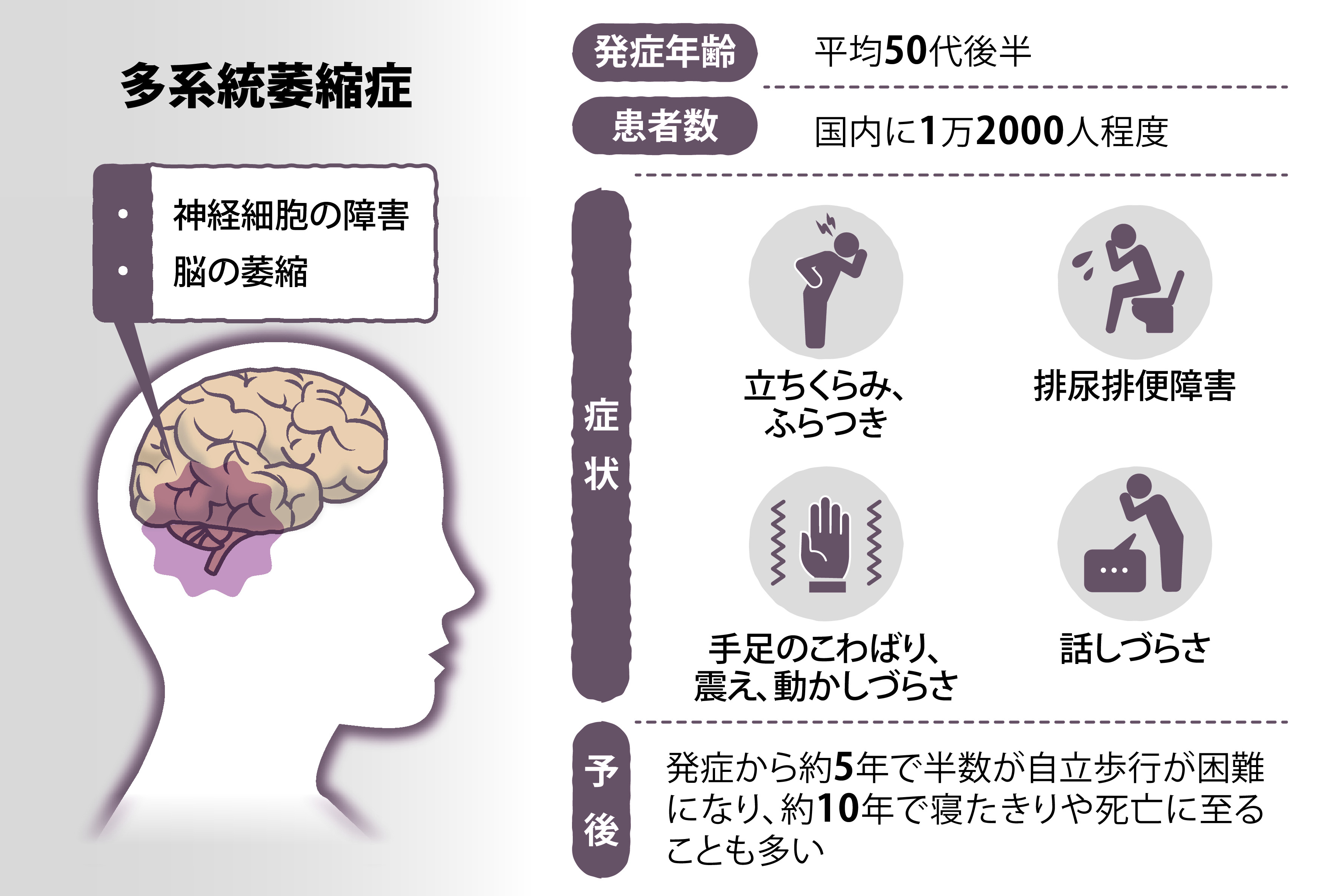 西城秀樹の知られざる真実！脳梗塞の陰で隠し続けた難病の全貌