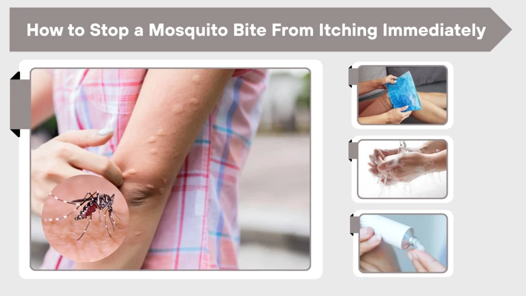 What Can Stop Mosquito Bites from Itching