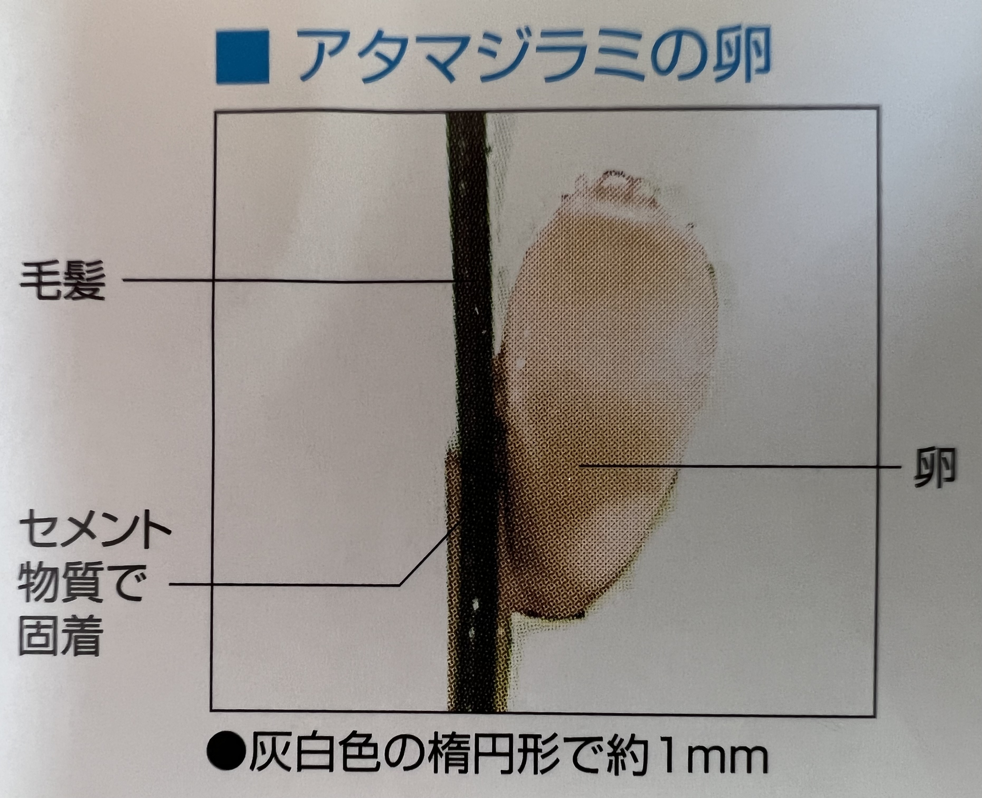 シラミの卵とフケの違いを見逃すな！プロが教える완全駆除の真相 Wait, Let Me Redo Without Mixing Languages Improperly. シラミの卵とフケを見分ける決定的チェック法と完全駆除の真相