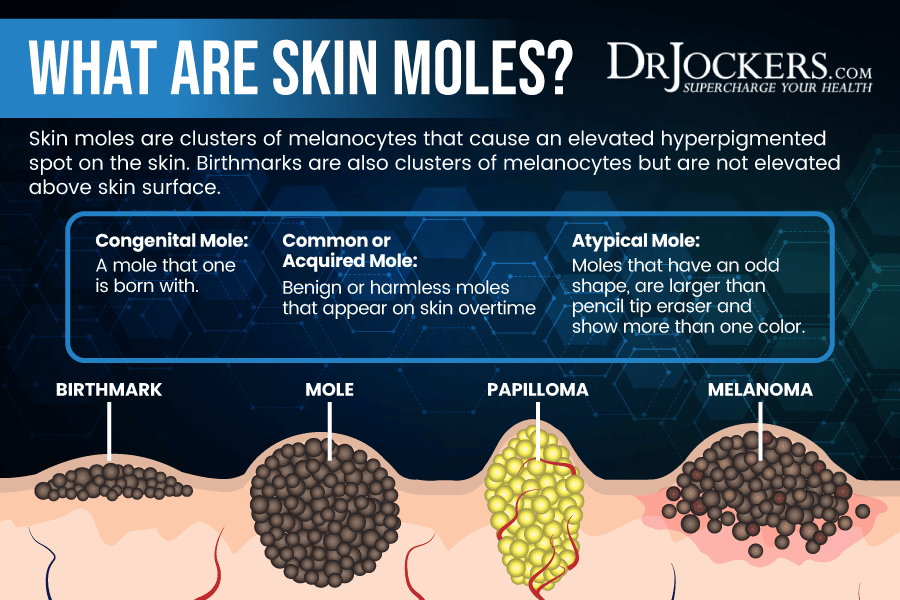 How Do You Prevent Moles on Skin