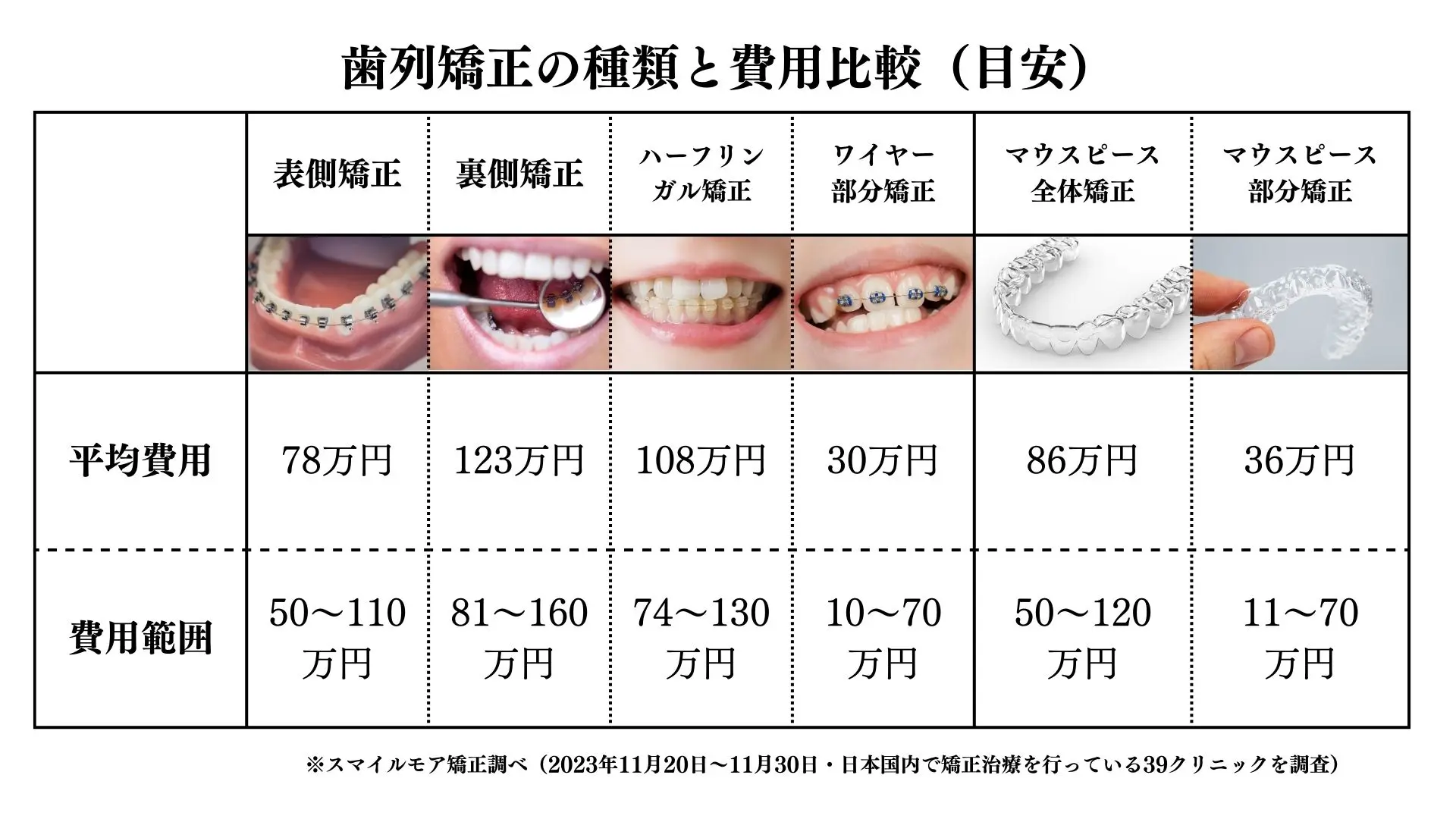 歯並び矯正の値段は総額いくら？2026年最新相場と安く抑える秘訣