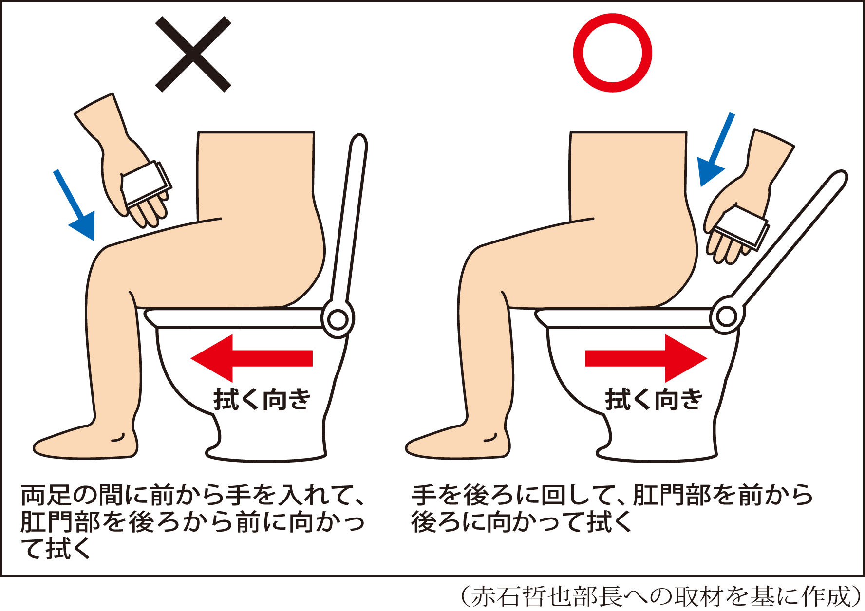 ゴシゴシ拭きはNg！専門医が明かす正しい便の拭き方と痔予防