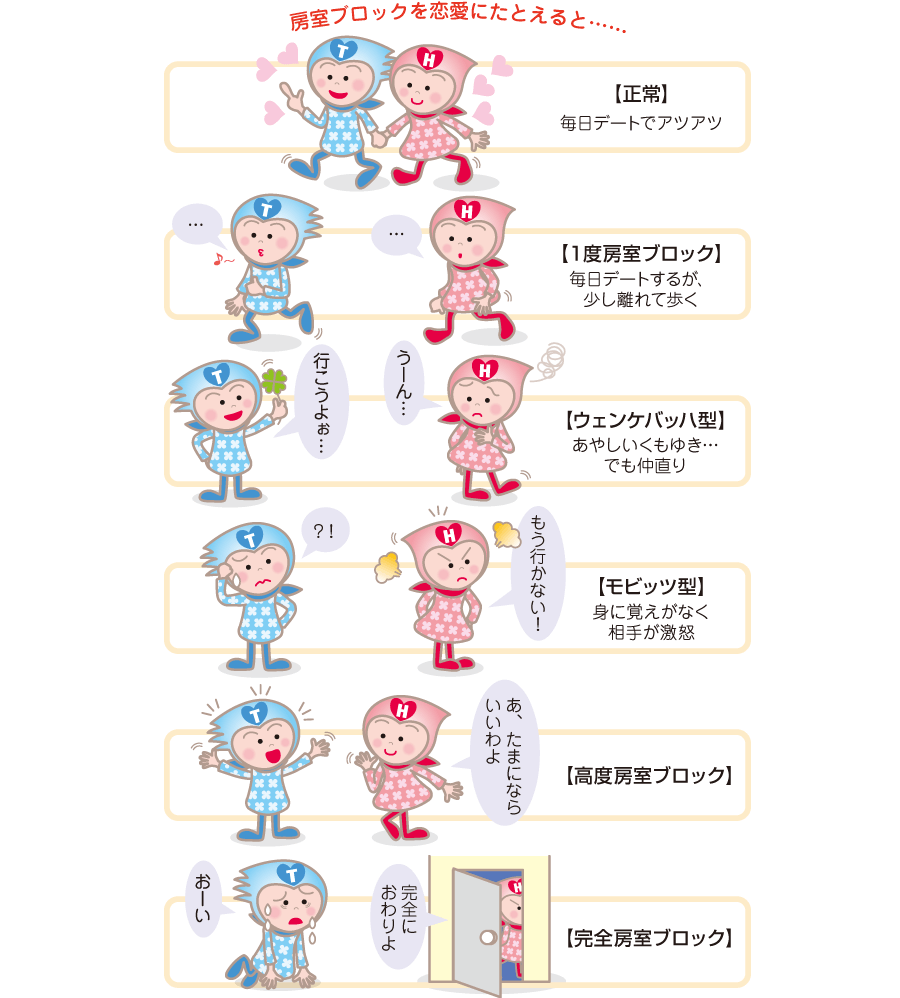 2:1房室ブロックは危険？突然死リスクとペースメーカー基準を解説
