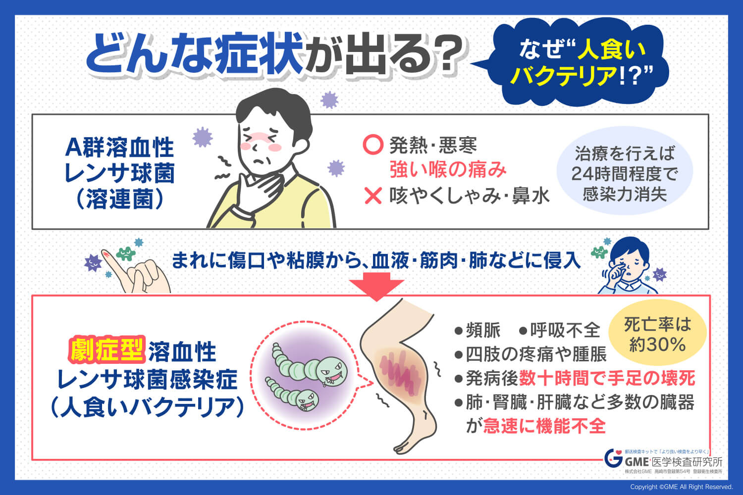 わずか数時間で急変？人食いバクテリアの初期症状と見落とせぬ異変