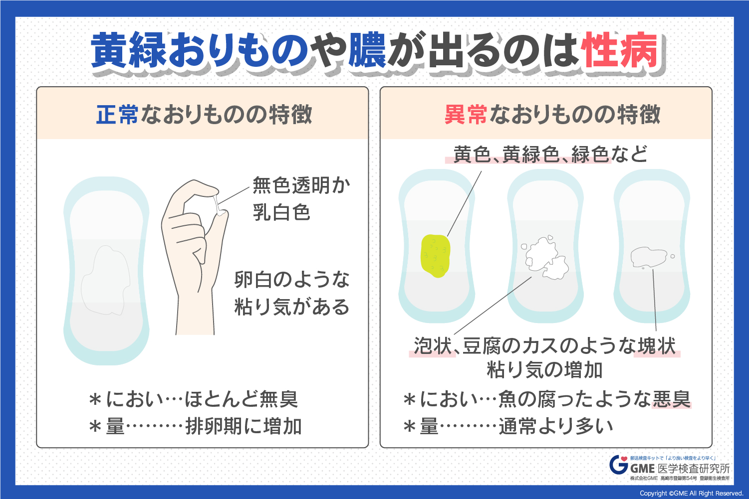 黄緑で泡立つ異変はなぜ？トリコモナスおりものの特徴と対処法を徹底解説