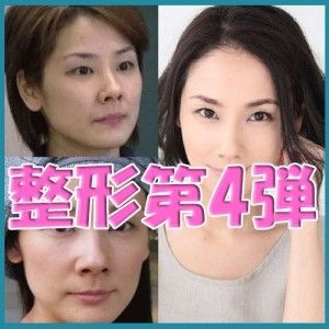 【最新】 目頭 切開 やりすぎ 芸能人 Tiktok話題の動画 #929