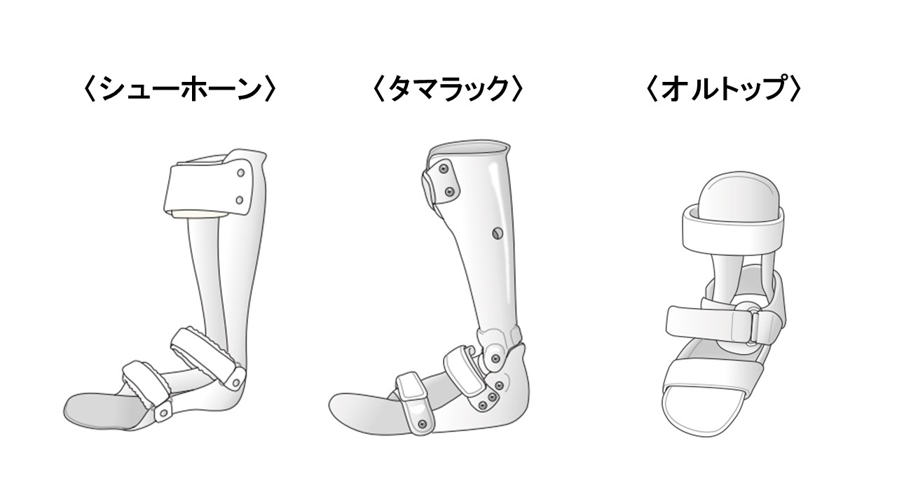 短下肢装具の種類と選び方決定版！特徴や費用・適応の真相【2026年】