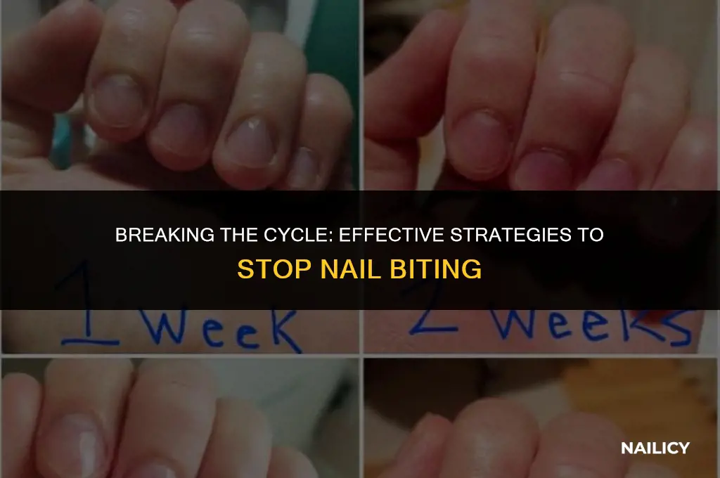 How to Stop Nail Biting Effective Methods