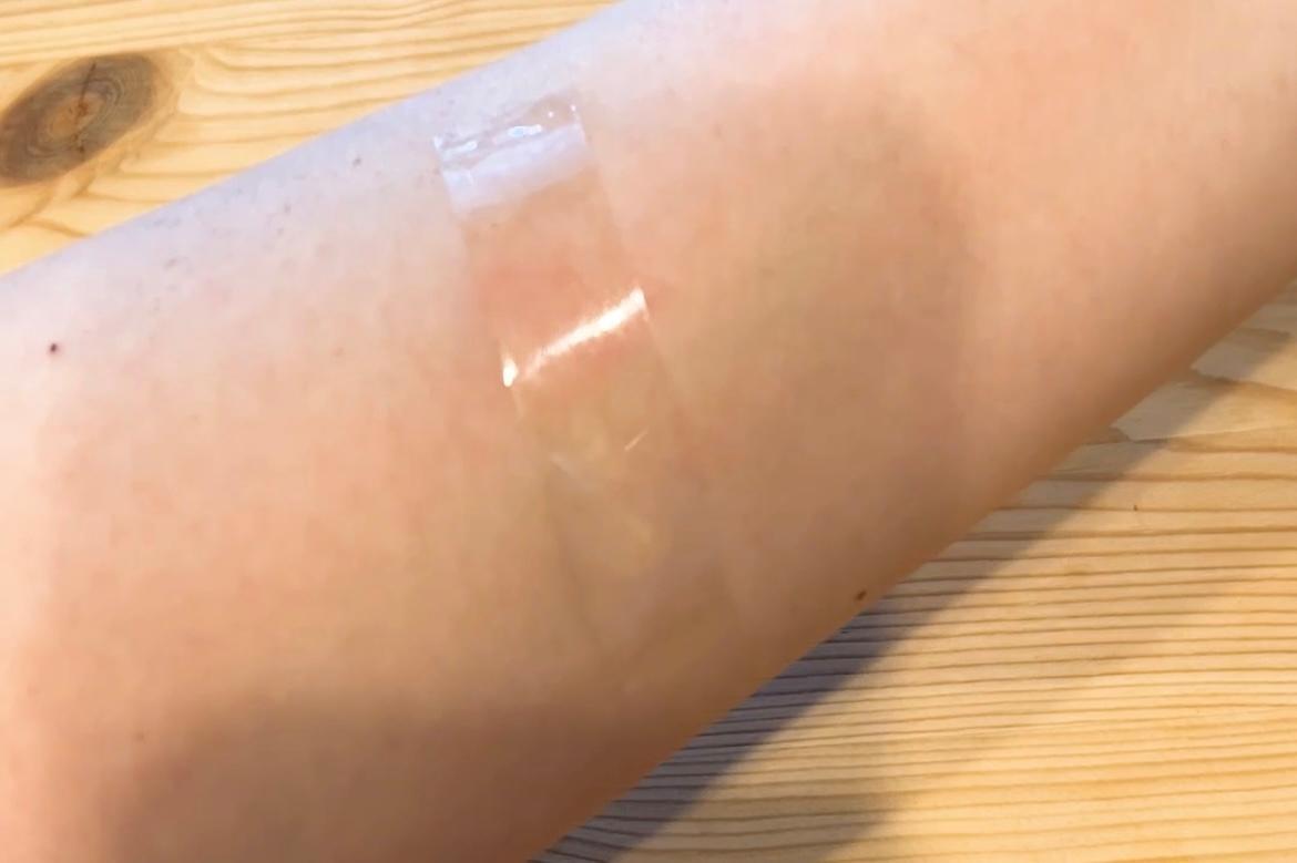 蚊に刺されたらセロテープは危険？痒みが止まる噂の真相と医学的根拠