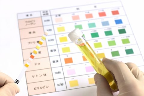 「生理中の尿検査」は避けるべき？健康診断で焦らないための最新対策と再検査を防ぐ境界線