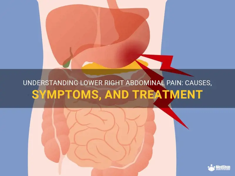 Pain Lower Right Side of Abdomen