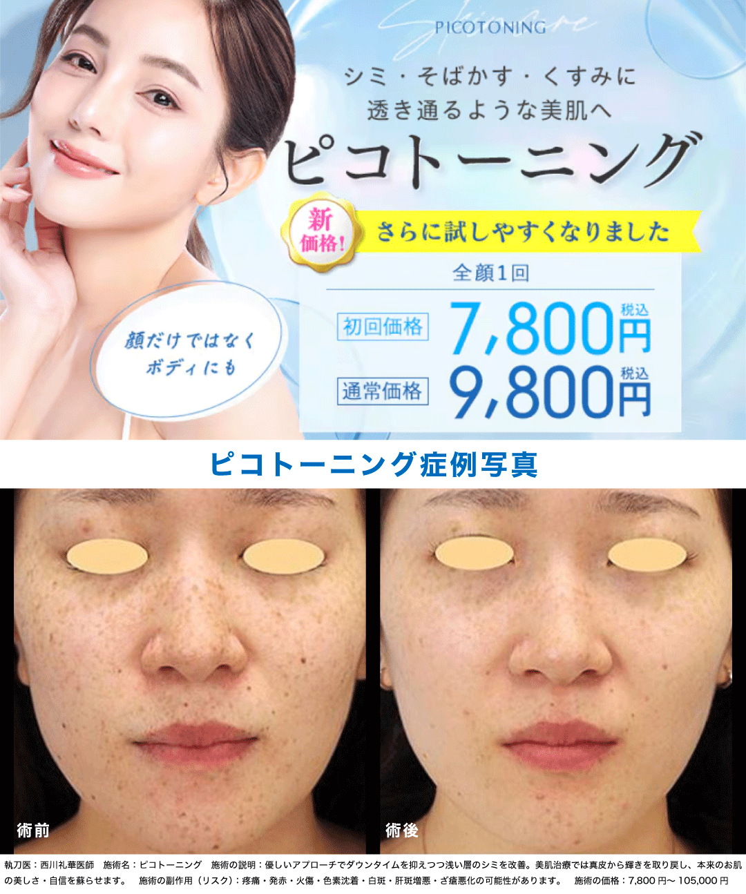 湘南美容外科ピコトーニングの口コミ検証｜効果ない噂と費用の真相
