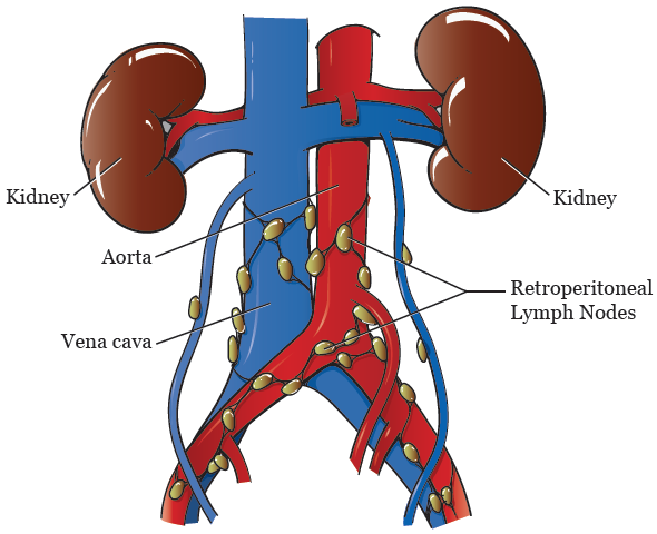 Where Are the Retroperitoneal Lymph Nodes