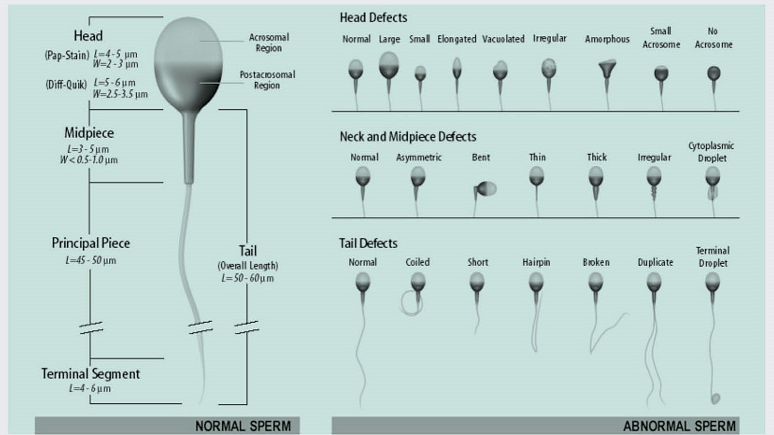 Sperm Morphology Percent