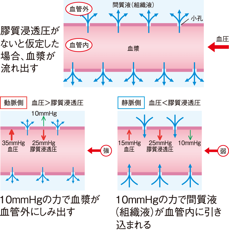 頑固な浮腫の黒幕を暴く！血漿膠質浸透圧とアルブミン低下の全貌