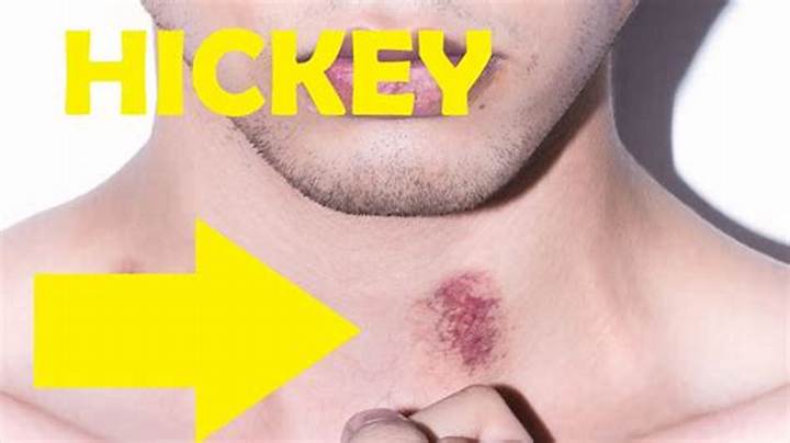 How Do I Make a Hickey? Safe, Clear Answers and What Actually Works