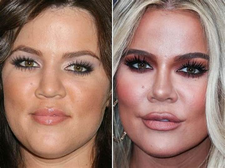 Khloe Kardashian Before and After: What Changed, What Didn’t